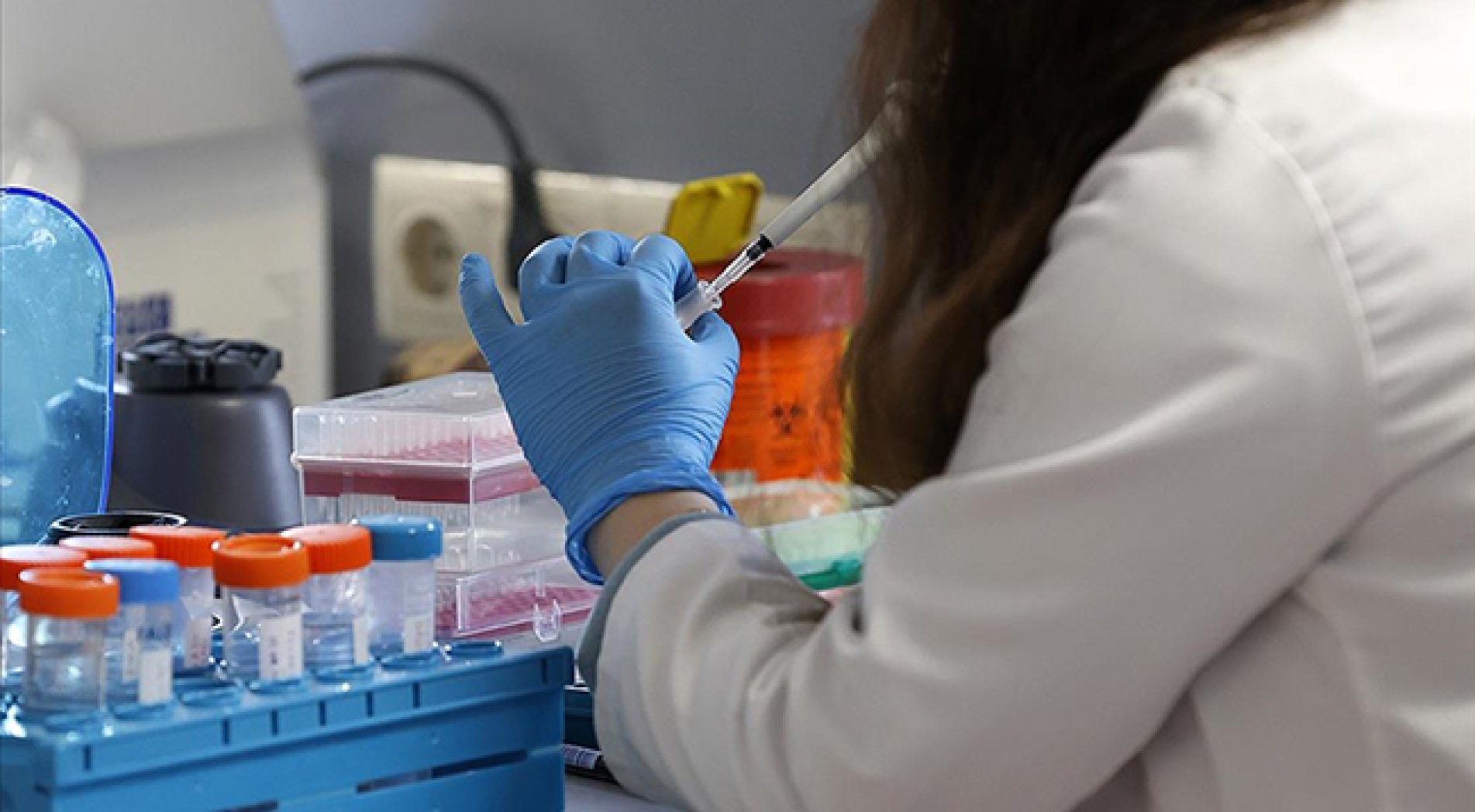 DSÖ'ye göre dünya genelinde maymun çiçeğinden 3 kişi öldü