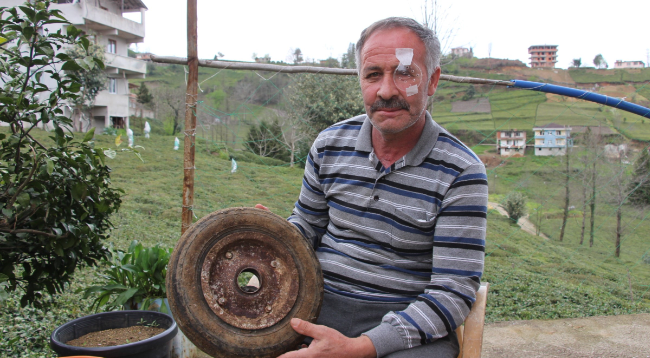 Lastiğe hava bastı, gözünden oldu