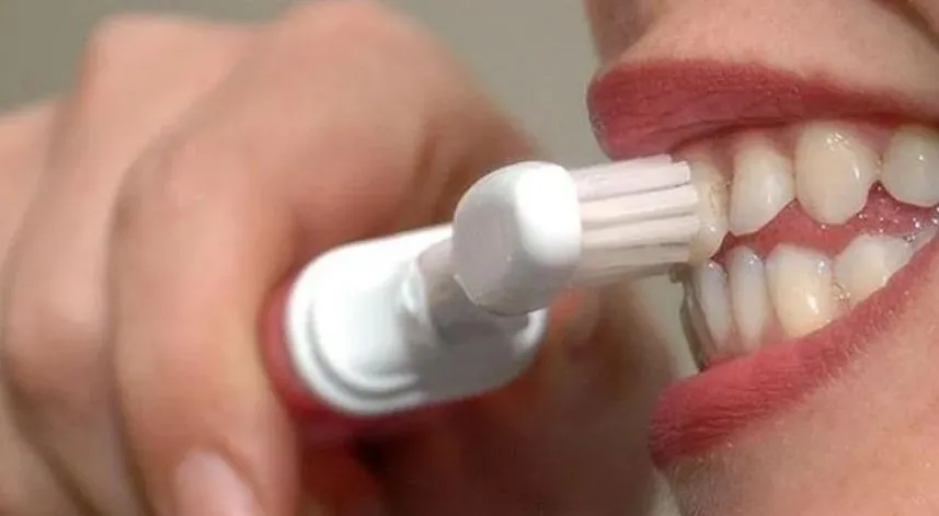 İnternetten alınan diş beyazlatma kitlerine dikkat
