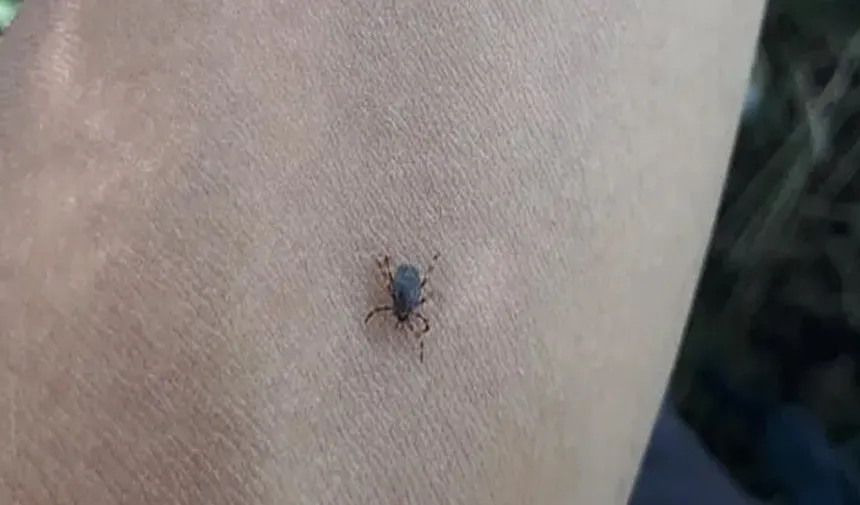 Bolu'da kenenin ısırdığı kadın öldü