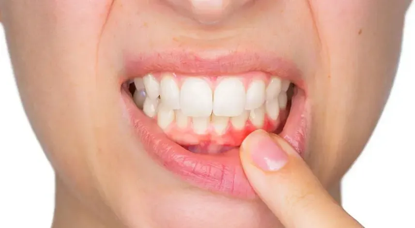 Diş enfeksiyonları ciddi komplikasyonlara yol açabilir