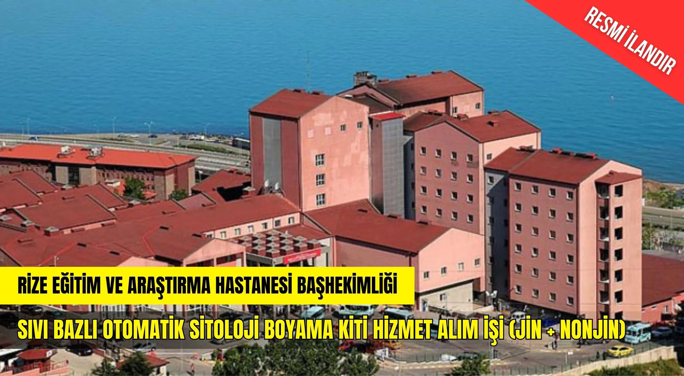 SIVI BAZLI OTOMATİK SİTOLOJİ BOYAMA KİTİ HİZMET ALIM İŞİ (JİN + NONJİN)