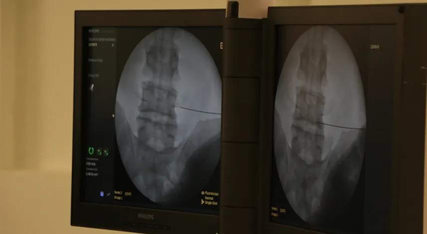 Fıtıkla uzun süre yaşamak ciddi risklere neden olabiliyor