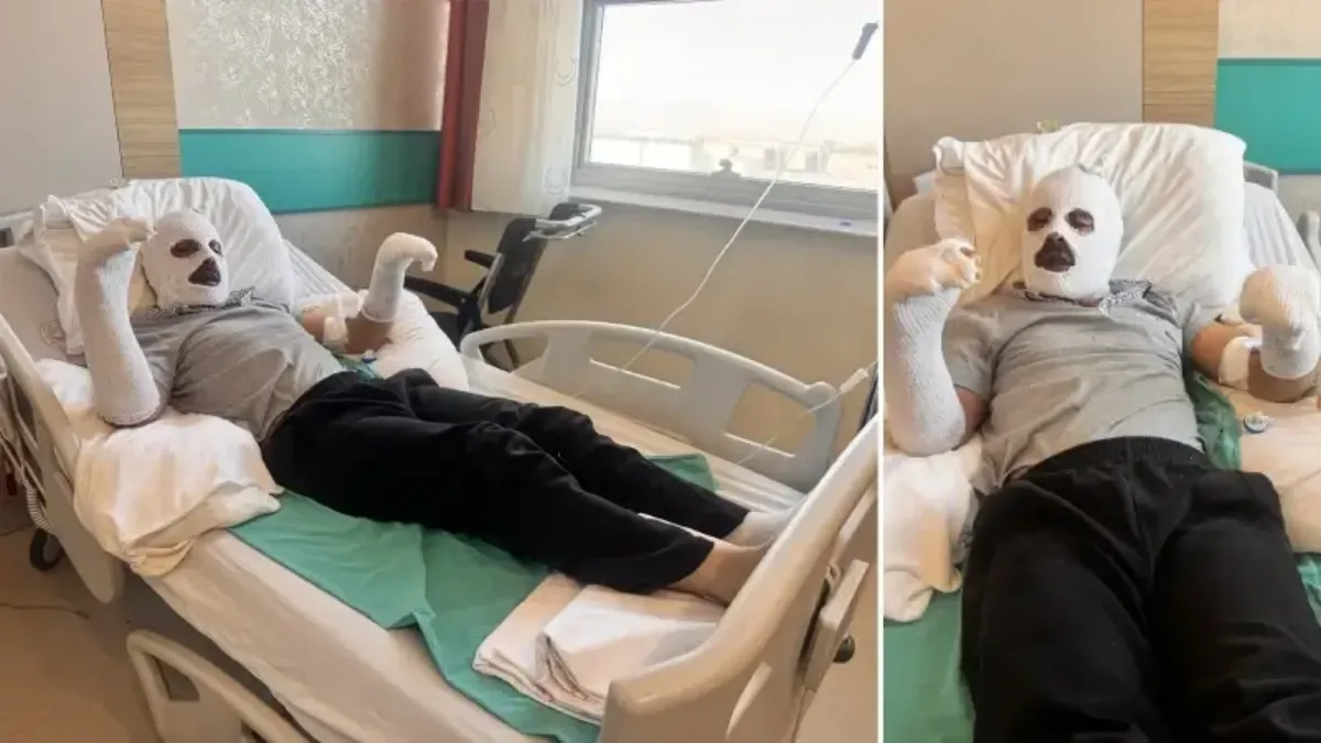 Çay demlerken gaz kaçağını fark edemeyen işitme engelli gencin vücudunun yüzde 26'sı yandı