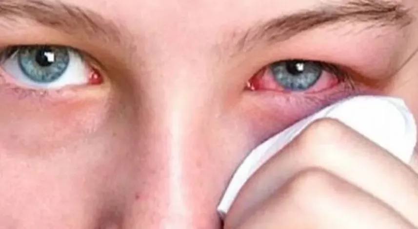 Kışla birlikte gelen göz enfeksiyonlarına dikkat