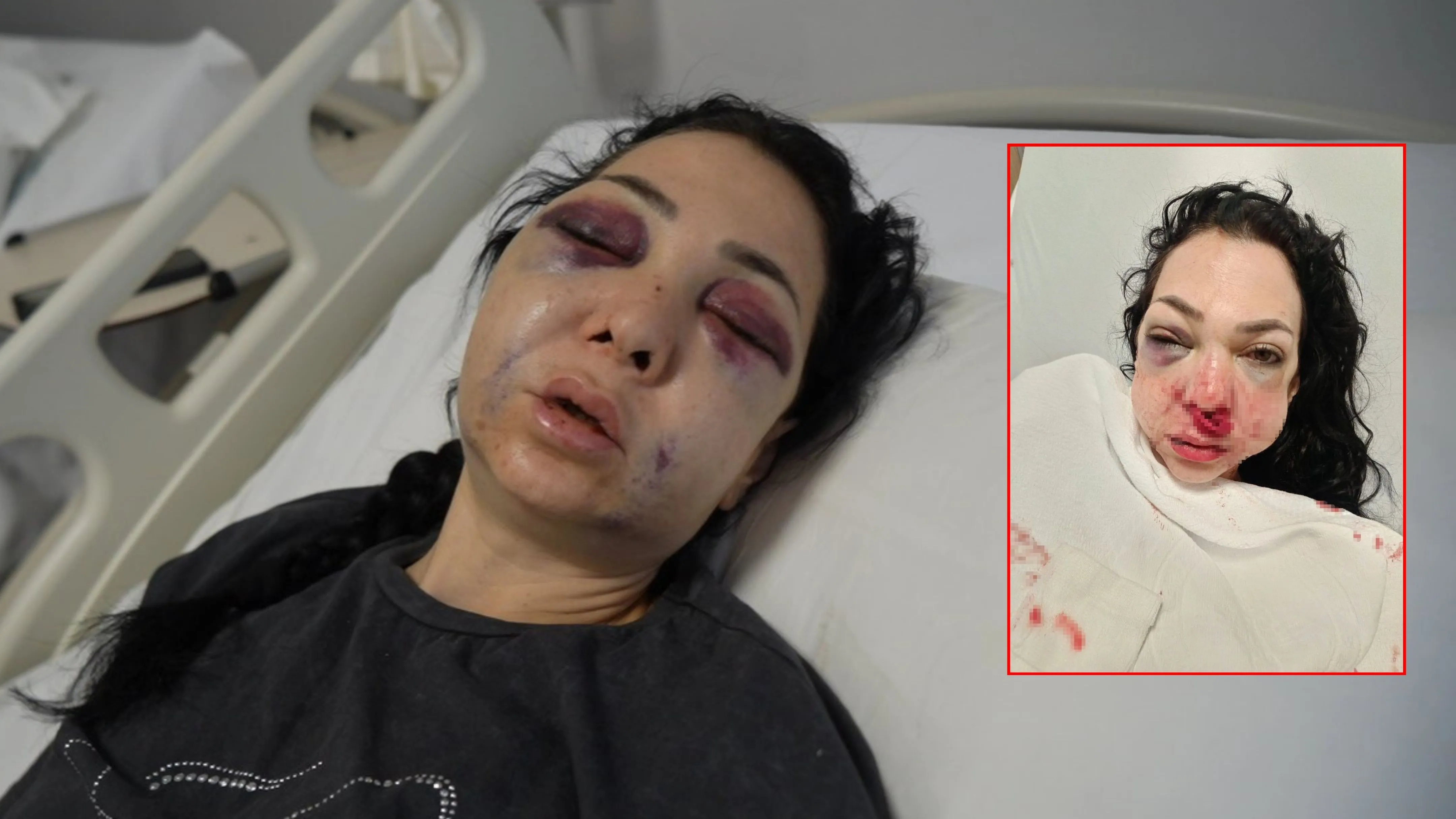 Oğlunun gözü önünde anneyi öldüresiye dövdüler: 'Küfür etmeyin' dedik diye bu hale geldim