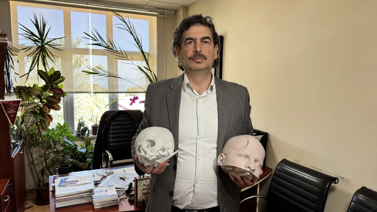 Yüzdeki şekil bozukluğu